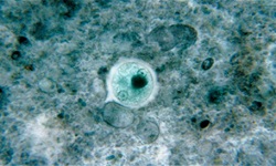 Entamoeba histolytica